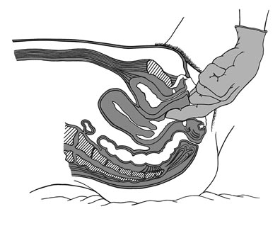 The G Spot and Sexual Function