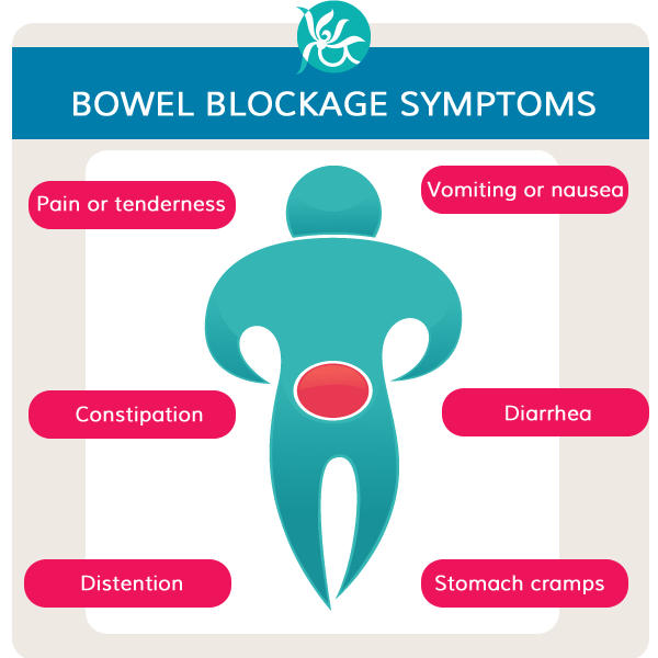 Symptoms of Blocked Bowel