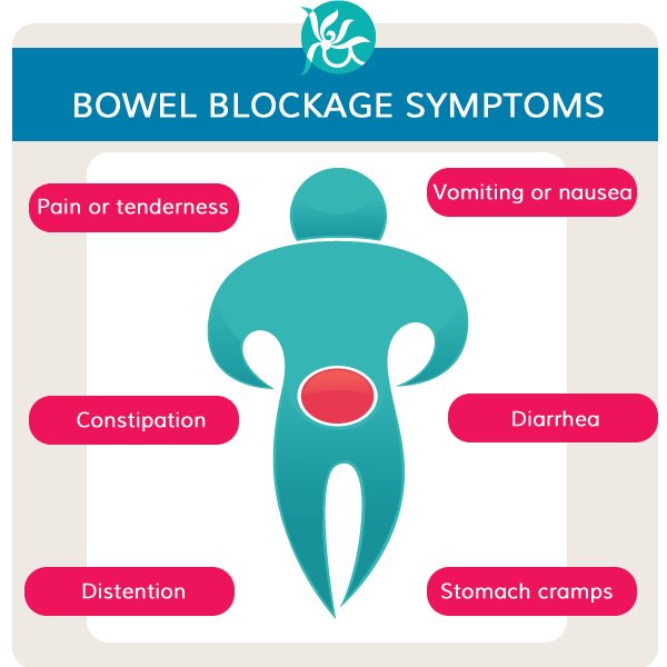 symptoms-of-bowel-obstruction-general-center-steadyhealth