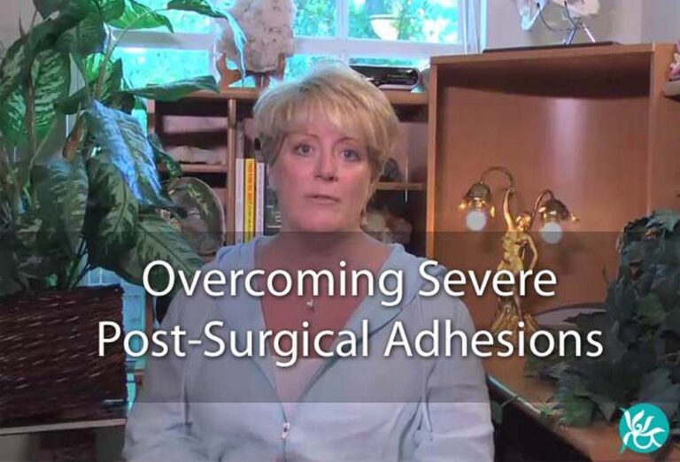 Post-Surgical Pain and Adhesions - Clear Passage