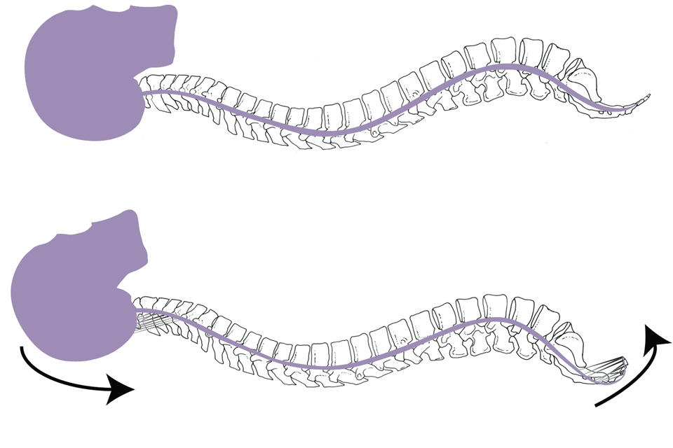 Tailbone Coccyx Pain Clear Passage