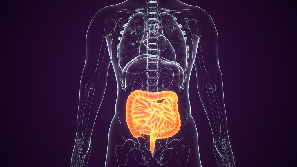 Bowel Obstruction or Intestinal Blockage