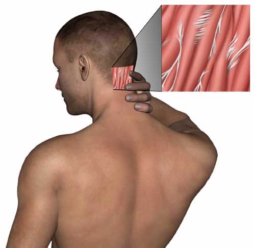 Scar Tissue and Adhesion Treatment